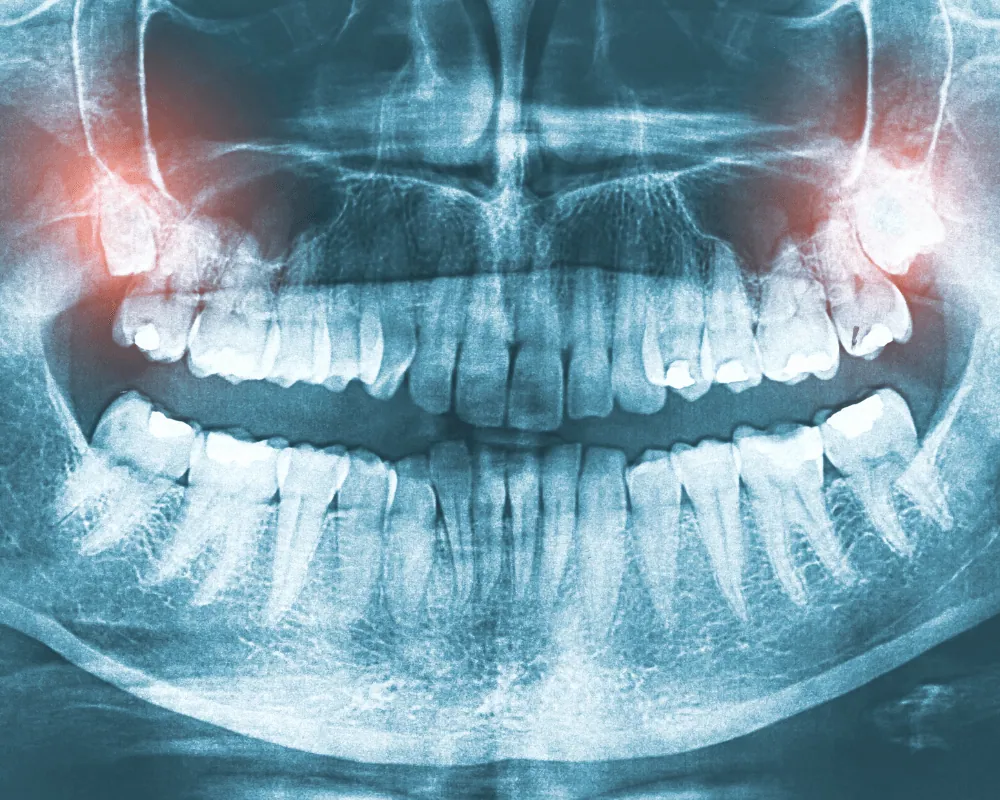 AĞIZ DİŞ VE ÇENE CERRAHİSİ